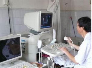 全数字化彩超